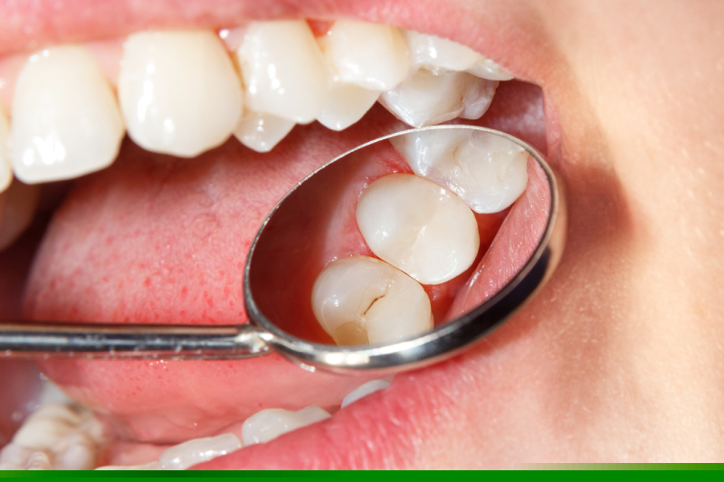 Dentist in Colorado Springs